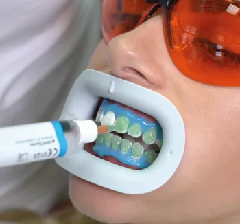 Vor der Zahnaufhellung